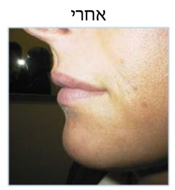 lips
